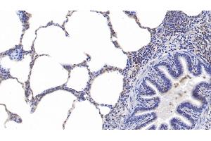 Detection of PSME3 in Human Lung Tissue using Polyclonal Antibody to Proteasome Activator Subunit 3 (PSME3)