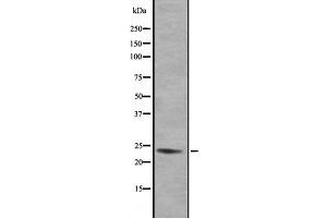 Western blot analysis of GEM expression in 293 lysate,The lane on the left is treated with the antigen-specific peptide. (GEM anticorps  (N-Term))