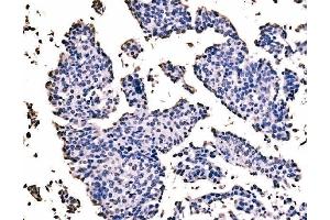 IHC analysis of splicing factor 1 using anti-splicing factor 1 antibody (ABIN7600194). (Splicing Factor 1 anticorps  (AA 160-266))
