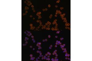 Immunofluorescence analysis of R.