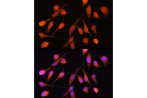 Immunofluorescence analysis of HeLa cells using PPM1A Rabbit pAb (ABIN6132507, ABIN6146039, ABIN6146040 and ABIN6222411) at dilution of 1:100 (40x lens).