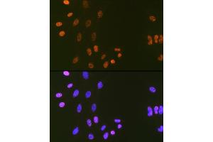 Immunofluorescence analysis of C6 cells using DNA Ligase I Rabbit mAb (ABIN7268251) at dilution of 1:100 (40x lens).