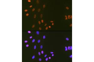 Immunofluorescence analysis of C6 cells using DNA Ligase I Rabbit mAb (ABIN7268251) at dilution of 1:100 (40x lens). (LIG1 anticorps)