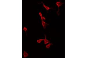 anti-Calmodulin 1 (Calm1) antibody