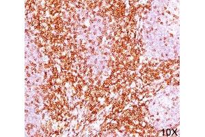 IHC testing of human tonsil (10X) stained with CD6 antibody cocktail (C6/372 + 3F7B5). (CD6 anticorps)