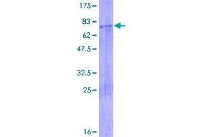 Image no. 1 for ATPase Family, AAA Domain Containing 2 (ATAD2) protein (GST tag) (ABIN2752722)