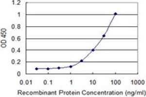 Detection limit for recombinant GST tagged SLPI is 0.