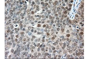 Immunohistochemical staining of paraffin-embedded Human colon tissue using anti-ERCC1 mouse monoclonal antibody. (ERCC1 anticorps)