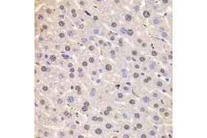 Immunohistochemistry of paraffin-embedded Mouse liver using HNRNPD antibody at dilution of 1:100 (x400 lens). (HNRNPD/AUF1 anticorps)