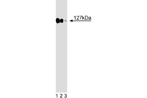 Western blot analysis of DDB1 on a HeLa cell lysate (Human cervical epitheloid carcinoma, ATCC CCL-2. (DDB1 anticorps  (AA 739-935))