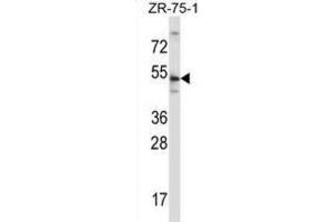 Western Blotting (WB) image for anti-Telomeric Repeat Binding Factor 2 (TERF2) antibody (ABIN2997581) (TRF2 anticorps)