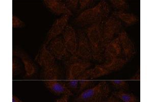 Immunofluorescence analysis of U-2 OS cells using SEPT8 Polyclonal Antibody at dilution of 1:100. (Septin 8 anticorps)