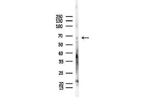 anti-Arylsulfatase E (ARSE) (Internal Region) antibody