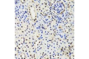 Immunohistochemistry of paraffin-embedded mouse kidney using EFTUD2 Antibody.