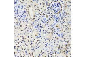 Immunohistochemistry of paraffin-embedded mouse kidney using EFTUD2 Antibody. (EFTUD2 anticorps  (AA 1-205))