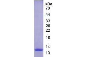 SDS-PAGE of Protein Standard from the Kit (Highly purified E. (MMP12 Kit ELISA)
