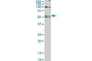 SMAD5 monoclonal antibody (M01), clone 2D7. (SMAD5 anticorps  (AA 105-182))