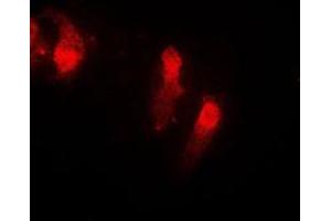 Immunofluorescent analysis of Cystatin B staining in EOC20 cells.