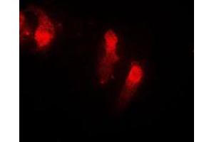 Immunofluorescent analysis of Cystatin B staining in EOC20 cells. (CSTB anticorps  (Center))