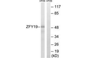 Western blot analysis of extracts from HT-29 cells, using ZFYVE19 Antibody. (ZFYVE19 anticorps  (AA 311-360))