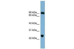 VPS53 antibody used at 1 ug/ml to detect target protein. (VPS53 anticorps)
