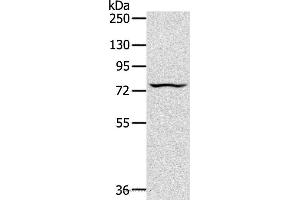 Western blot analysis of Jurkat cell, using TAP2 Polyclonal Antibody at dilution of 1:200 (TAP2 anticorps)