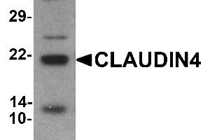 Western blot analysis of CLAUDIN4 in human colon tissue lysate with CLAUDIN4 antibody at 1 µg/mL (Claudin 4 anticorps  (C-Term))