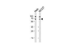 All lanes : Anti-GNL3 Antibody (N-term) at 1:2000 dilution Lane 1: Hela whole cell lysates Lane 2: NCCIT whole cell lysates Lysates/proteins at 20 μg per lane. (Nucleostemin anticorps  (N-Term))