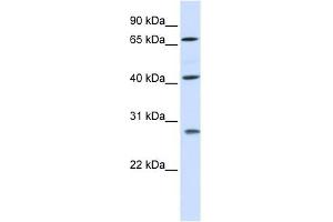 RDM1 antibody used at 1 ug/ml to detect target protein. (RDM1 anticorps  (Middle Region))