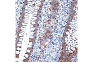 Immunohistochemistry of paraffin-embedded human appendix using Creatine kinase B type (CKB) Rabbit mAb (ABIN7266515) at dilution of 1:100 (40x lens). (CKB anticorps)
