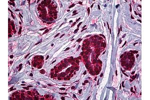 Anti-MDM2 antibody IHC of human breast. (MDM2 anticorps  (AA 101-201))