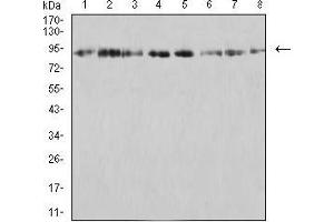 Western blot analysis using KDM1A mouse mAb against SK-Br-3 (1), K562 (2), SW480 (3), Jurkat (4), Hela (5), COS7 (6), T47D (7), and HCT116 (8) cell lysate.