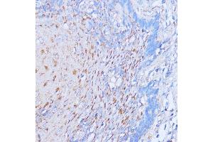 Immunohistochemistry of paraffin-embedded human esophageal using NME6 antibody (ABIN7268942) at dilution of 1:100 (40x lens). (NME6 anticorps  (AA 9-194))