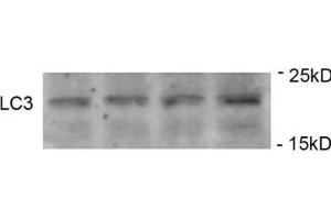 Western Blotting (WB) image for anti-Microtubule-Associated Protein 1 Light Chain 3 gamma (MAP1LC3C) (pSer12) antibody (ABIN2970987)