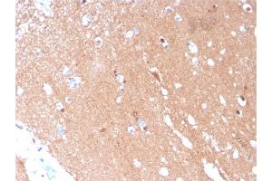Formalin-fixed, paraffin-embedded human Brain stained with Tubulin beta 3 Mouse Monoclonal Antibody (TUBB3/3731).