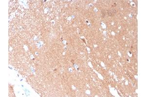 Formalin-fixed, paraffin-embedded human Brain stained with Tubulin beta 3 Mouse Monoclonal Antibody (TUBB3/3731). (TUBB3 anticorps  (AA 437-450))