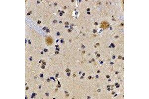 Immunohistochemical analysis of Lamin B Receptor staining in rat brain formalin fixed paraffin embedded tissue section. (Lamin B Receptor anticorps)
