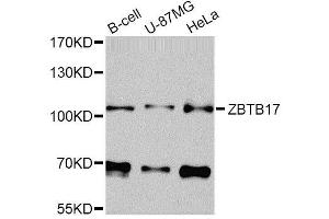 Western blot analysis of extracts of various cell lines, using ZBTB17 Antibody (ABIN5974597) at 1/1000 dilution. (ZBTB17 anticorps)