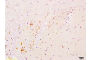 Immunohistochemistry (Paraffin-embedded Sections) (IHC (p)) image for anti-Glial Cell Line Derived Neurotrophic Factor (GDNF) (AA 121-211) antibody (ABIN736536)