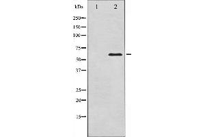 Western blot analysis of Src expression in COLO205 whole cell lysates,The lane on the left is treated with the antigen-specific peptide.