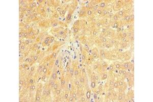 Immunohistochemistry of paraffin-embedded human liver tissue using ABIN7147720 at dilution of 1:100