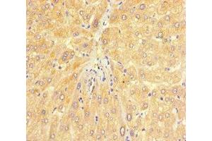 Immunohistochemistry of paraffin-embedded human liver tissue using ABIN7147720 at dilution of 1:100 (CHD4 anticorps  (AA 1-219))