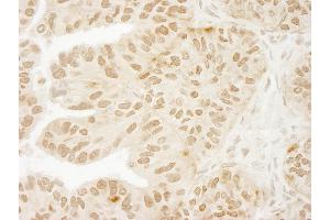 Immunohistochemistry (IHC) image for anti-Ubiquitin Specific Peptidase 15 (USP15) (C-Term) antibody (ABIN7448852) (USP15 anticorps  (C-Term))
