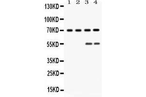 Western blot analysis of YAP1 expression in rat testis extract ( Lane 1), mouse ovary extract ( Lane 2), HELA whole cell lysates ( Lane 3) and MCF-7 whole cell lysates ( Lane 4). (YAP1 anticorps  (N-Term))