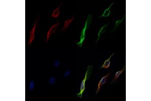 ABIN6266184 and ABIN6277405 staining Hela cells by IF/ICC.