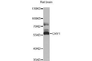 Western blot analysis of extracts of rat brain, using CRY1 antibody. (CRY1 anticorps)