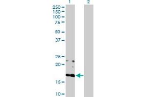 Western Blot analysis of BST2 expression in transfected 293T cell line by BST2 MaxPab polyclonal antibody. (BST2 anticorps  (AA 1-180))