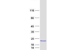 Regenerating Islet-Derived 1 beta (REG1B) protein (Myc-DYKDDDDK Tag)