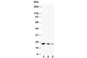 Western blot testing of CDC42 antibody and Lane 1:  ecombinant human protein 10ng (CDC42 anticorps  (Middle Region))