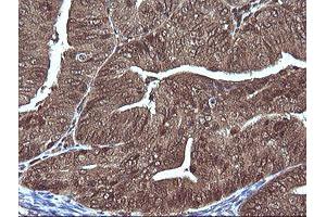 Image no. 5 for anti-Mitogen-Activated Protein Kinase Kinase 1 (MAP2K1) antibody (ABIN1499374)